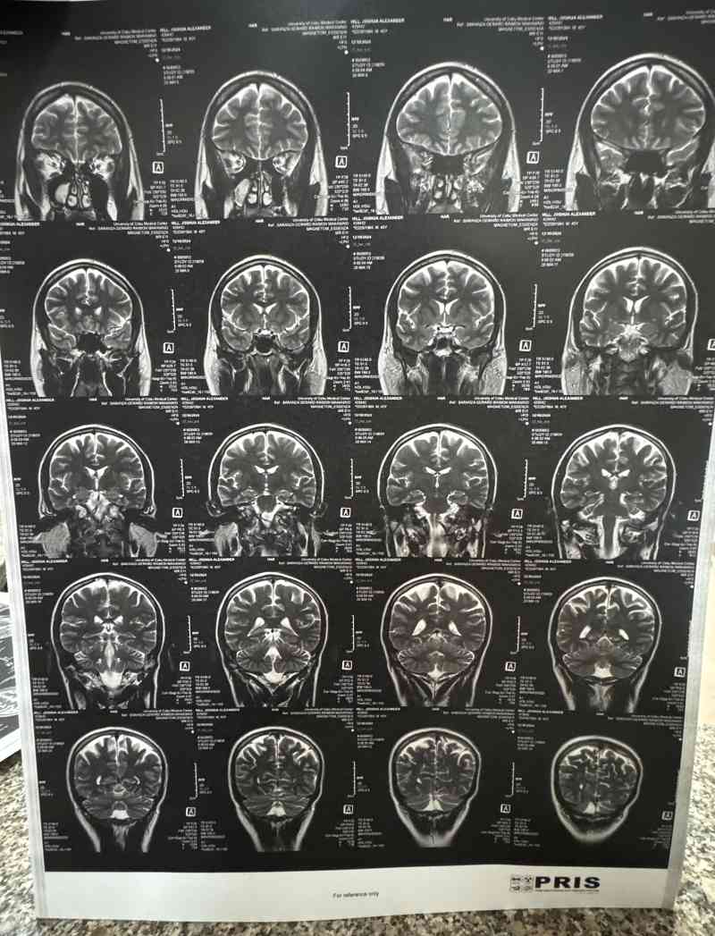 Brain Scan